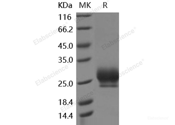 Recombinant Human RNF43 Protein (His tag)-Elabscience