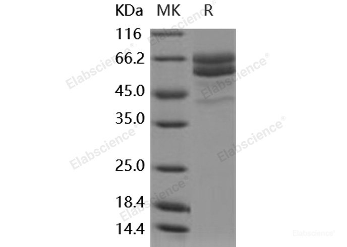 Recombinant Human FAM20C / DMP4 Protein (His Tag)-Elabscience