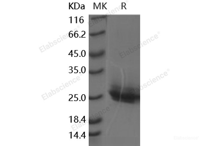 Recombinant Human Frizzled-10 / FZD10 Protein (His tag)-Elabscience