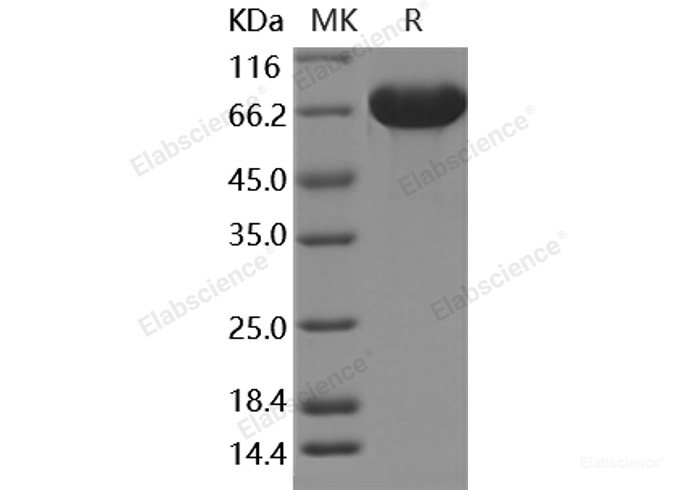 Recombinant Human A1BG / alpha 1B-Glycoprotein Protein (His Tag)-Elabscience