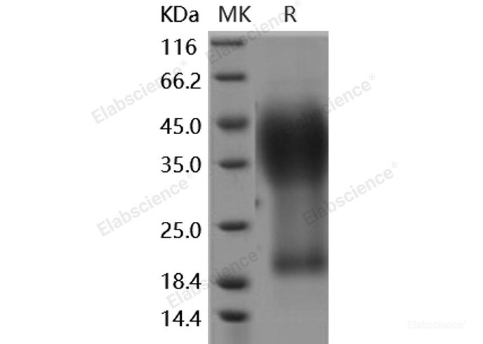 Recombinant Human GYPA / CD235a / Glycophorin A Protein (His tag)-Elabscience