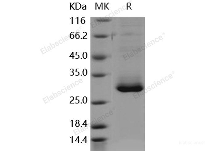 Recombinant Human RAB27B Protein (His tag)-Elabscience