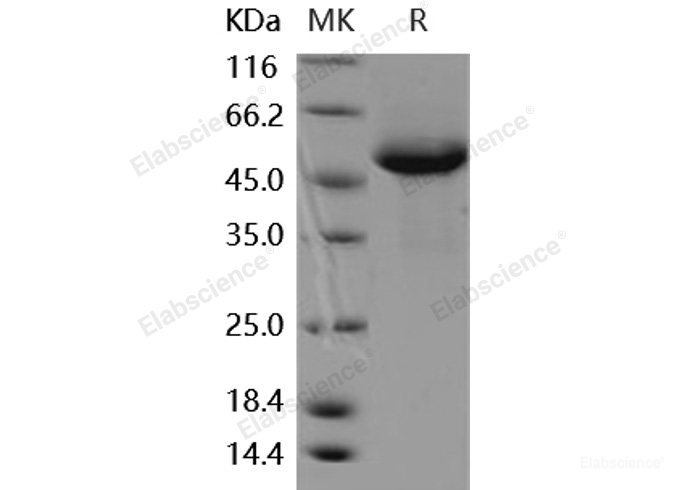 Recombinant Human RAB27B Protein (Fc tag)-Elabscience
