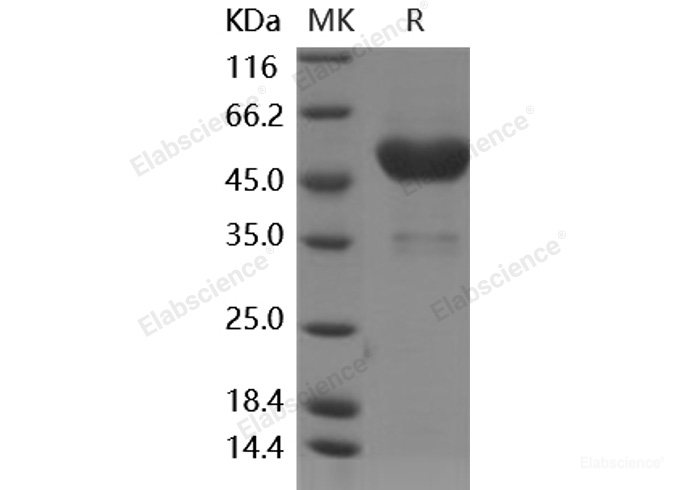 Recombinant Human Frizzled-6 / FZD6 Protein (Fc tag)-Elabscience
