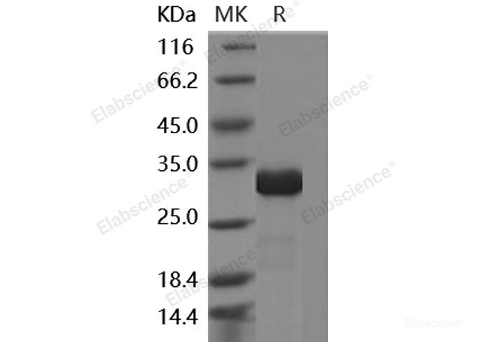 Recombinant Human IMP1 / IMPA1 Protein (His tag)-Elabscience