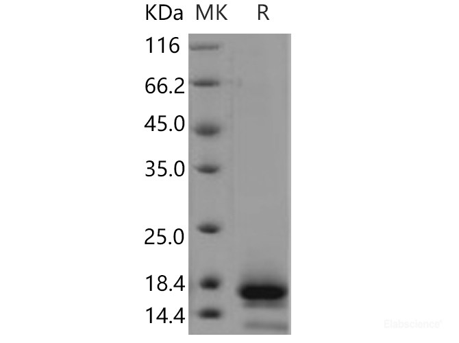 Recombinant Human TSPAN8 / Tetraspanin 8 / TM4SF3 Protein (His tag)-Elabscience