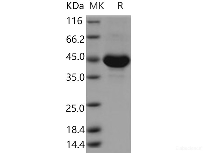 Recombinant Human TSPAN8 / Tetraspanin 8 / TM4SF3 Protein (Fc tag)-Elabscience