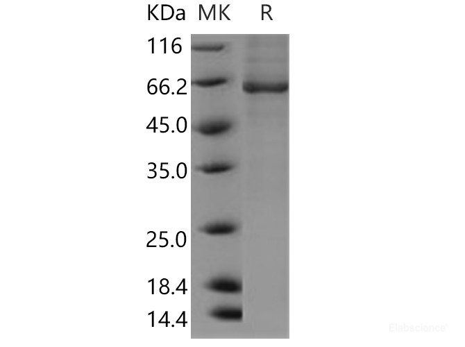Recombinant Human BBOX1 / Gamma-BBH Protein (His & GST tag)-Elabscience