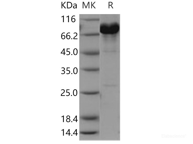 Recombinant Human NCF-2 / NCF2 / P67phox Protein (His & GST tag)-Elabscience
