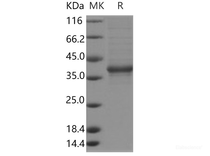Recombinant Human FAM150A Protein (Fc Tag)-Elabscience