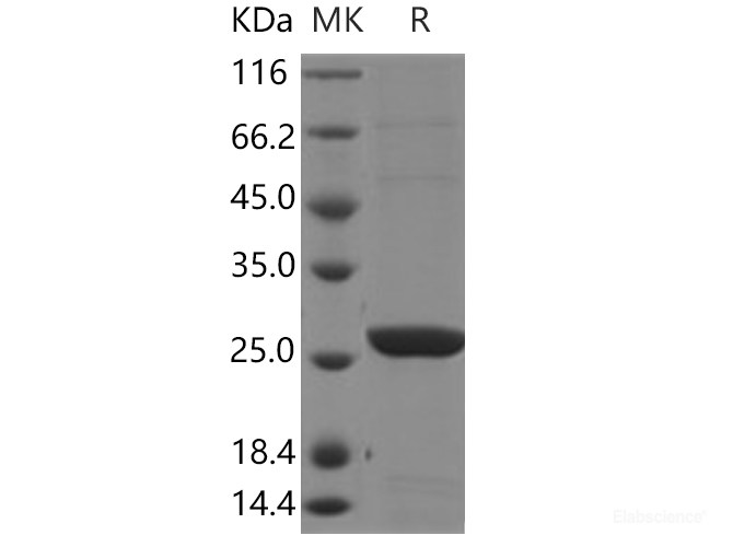 Recombinant Human Glutathione S-transferase theta-2B / GSTT2B Protein (His tag)-Elabscience