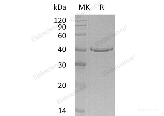 Recombinant Human GMPR Protein (His Tag)-Elabscience