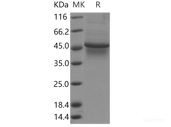 Recombinant Human TAPBP/ Tapasin Protein (His Tag)-Elabscience