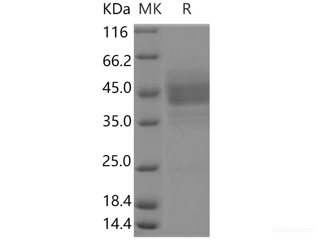 Recombinant Human EDNRB / Endothelin B Receptor Protein (Fc tag)-Elabscience