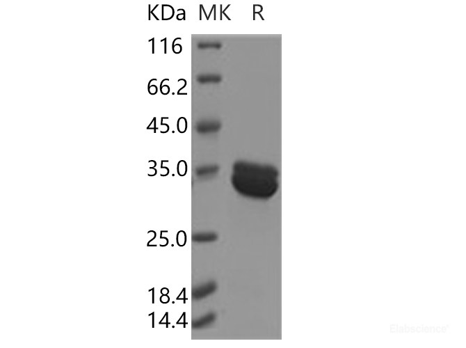 Recombinant Human Annexin A8 / ANXA8 Protein (His tag)-Elabscience