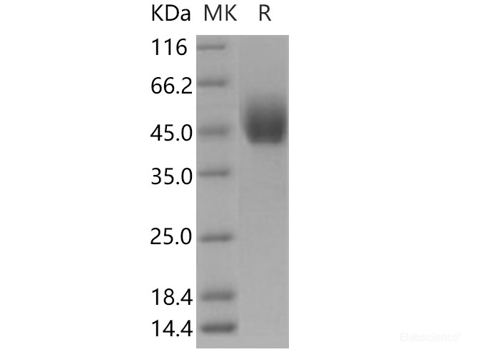 Recombinant Human DPEP2 Protein (Fc tag)-Elabscience
