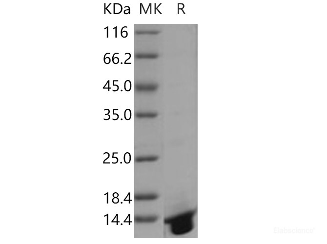 Recombinant Human DNAJC30 Protein (His tag)-Elabscience