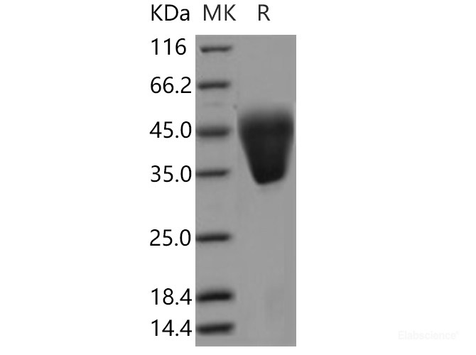 Recombinant Human KCT2 / C5orf15 Protein (His tag)-Elabscience