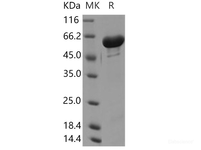 Recombinant Human GALNT2 / GalNAc-T2 Protein (His tag)-Elabscience