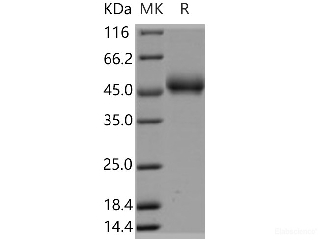 Recombinant Human FAM171B / KIAA1946 Protein (His tag)-Elabscience