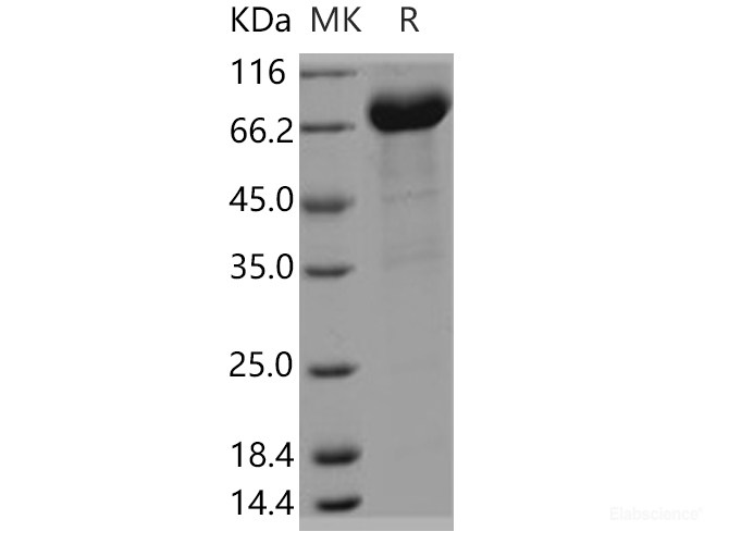 Recombinant Human FAM171B / KIAA1946 Protein (Fc tag)-Elabscience
