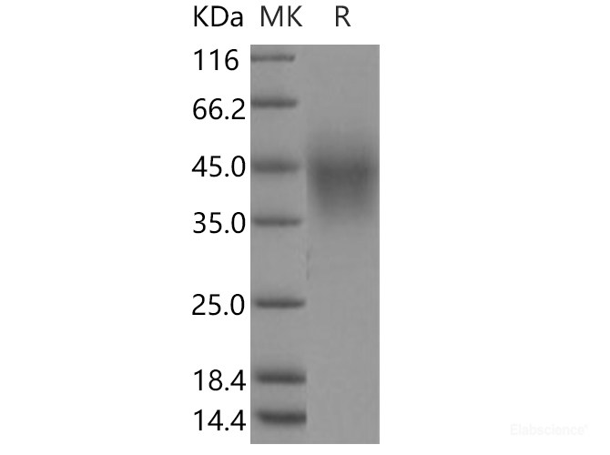 Recombinant Human TMEM25 Protein (His tag)-Elabscience