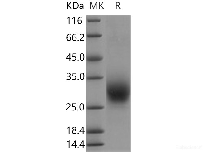 Recombinant Human RAMP3 Protein (Fc tag)-Elabscience