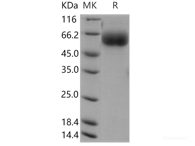 Recombinant Human AMIGO2 Protein (His tag)-Elabscience