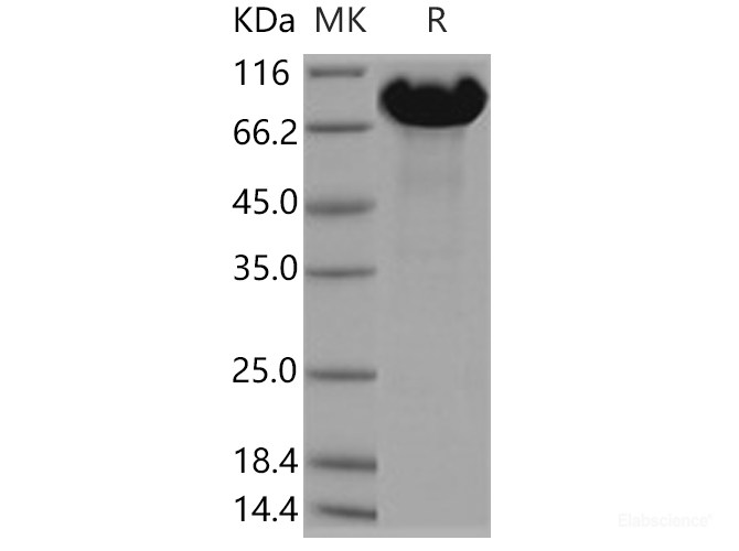 Recombinant Human APLP1 / Amyloid-like protein 1 Protein (His tag)-Elabscience