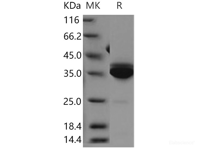 Recombinant Human Statherin / STATH Protein (Fc tag)-Elabscience