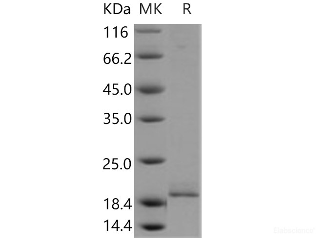 Recombinant Human PPP3R1 Protein (His tag)-Elabscience