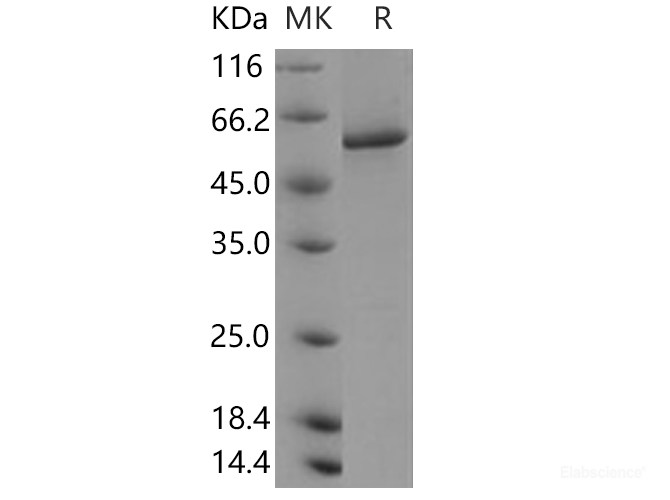 Recombinant Human PPP3CA / Protein phosphatase 2B Protein (His tag)-Elabscience