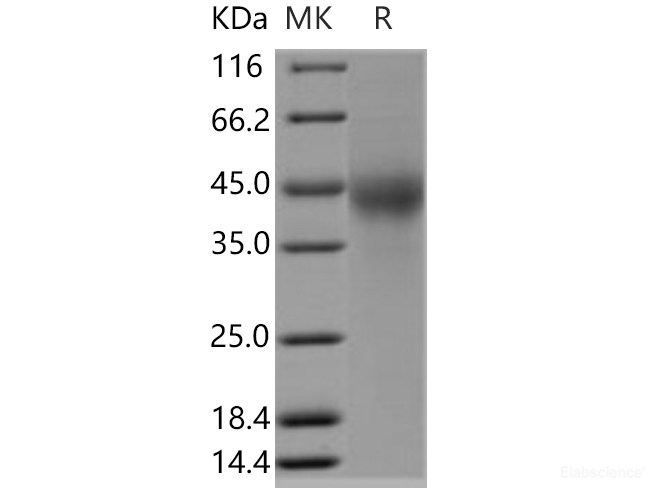 Recombinant Human TMUB2 Protein (His tag)-Elabscience