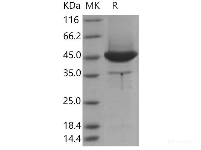 Recombinant Human MSN / Moesin Protein (aa 1-346, His tag)-Elabscience