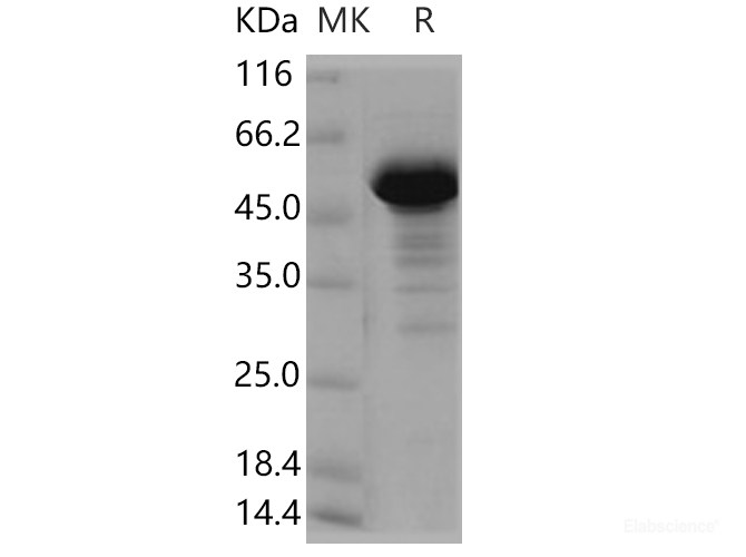 Recombinant Human NCKIPSD / SPIN90 Protein (GST tag)-Elabscience