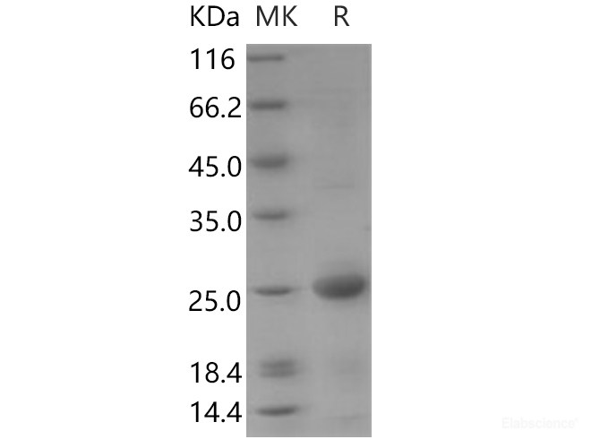 Recombinant Human BMF / Bcl2 modifying factor Protein (His tag)-Elabscience