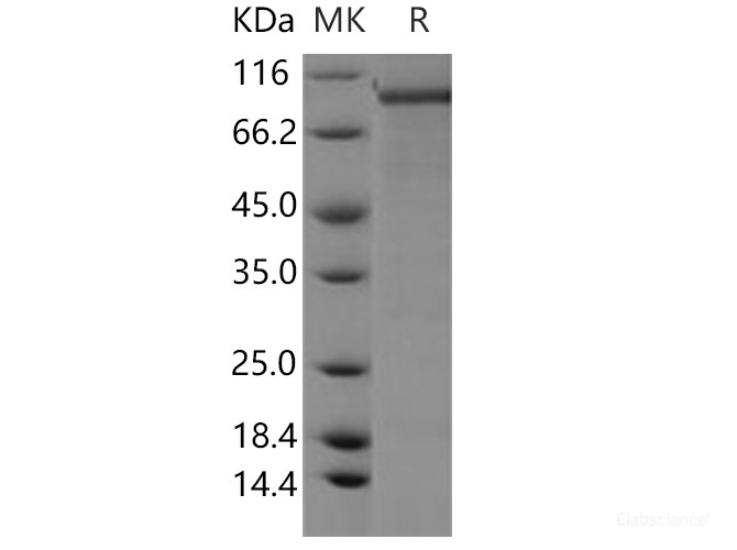 Recombinant Human PDE1C Protein (His & GST tag)-Elabscience