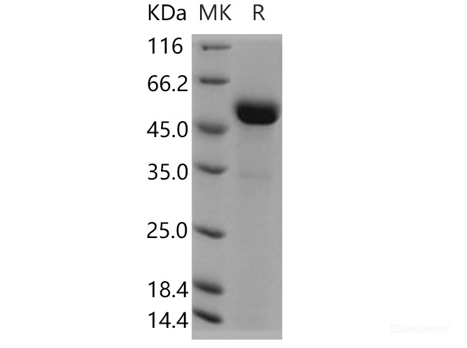 Recombinant Human ART3 Protein (His tag)-Elabscience