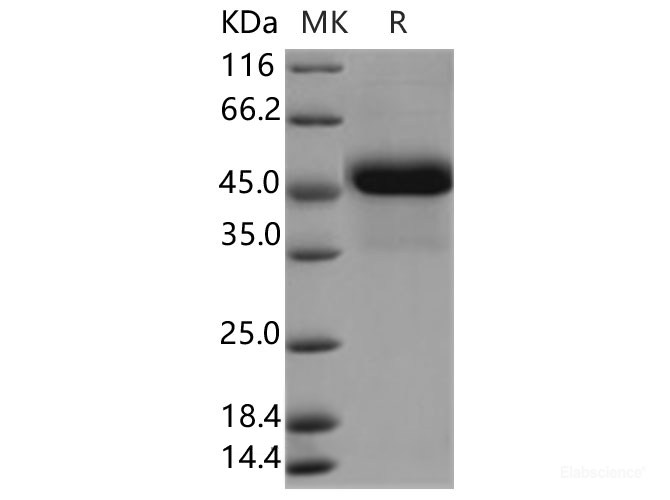 Recombinant Human Reticulocalbin 3 Protein (His Tag)-Elabscience