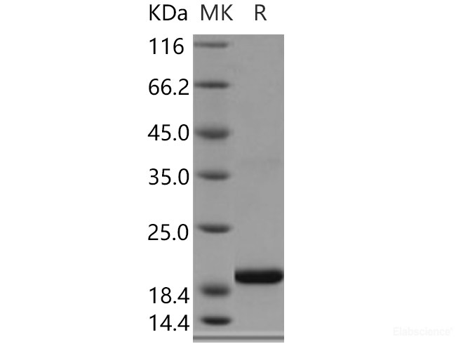 Recombinant Human SELM / Selenoprotein M Protein (His tag)-Elabscience