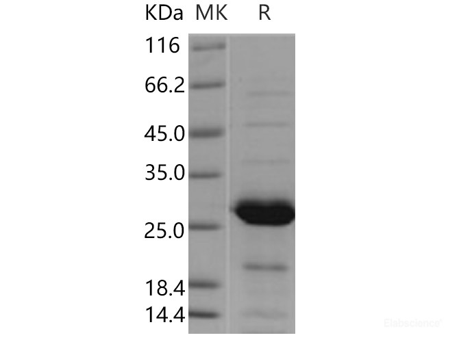 Recombinant Human PSPH Protein-Elabscience