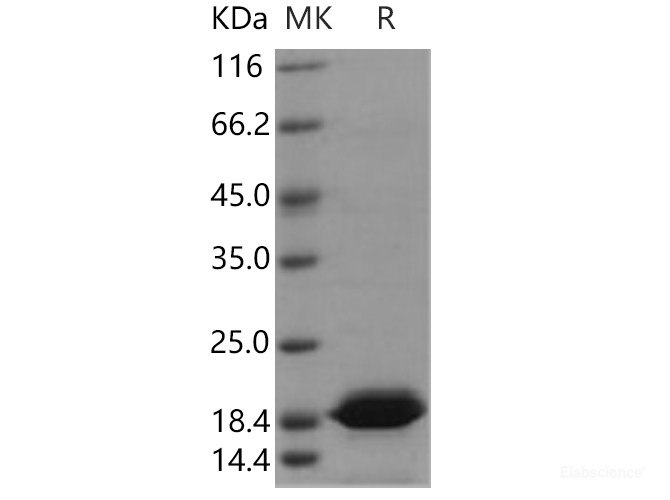 Recombinant Human Dim2 / TXNL4B Protein (His tag)-Elabscience