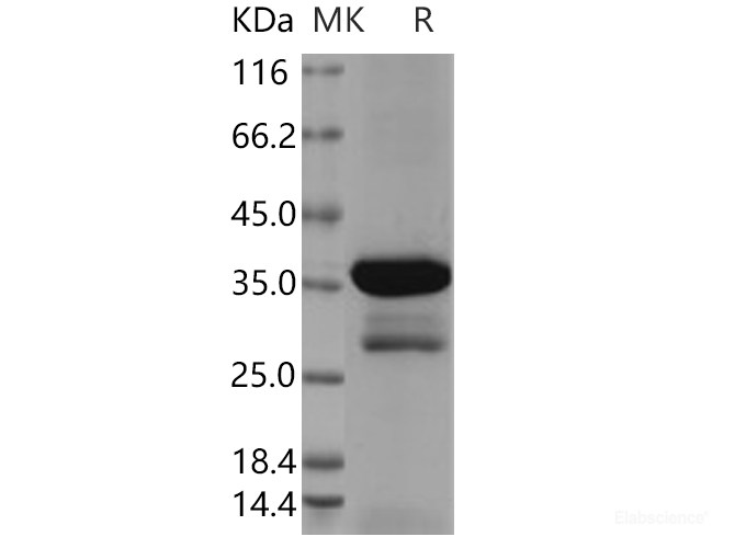 Recombinant Human DCX Protein (aa 45-150, GST tag)-Elabscience