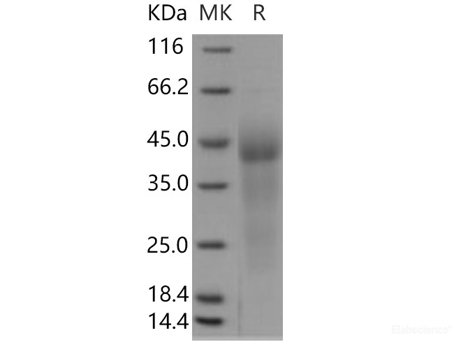 Recombinant Human GPR37 Protein (His tag)-Elabscience