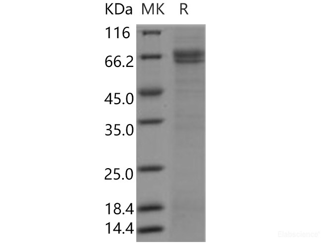 Recombinant Human SUSD4 / Sushi domain-containing protein 4 Protein (Fc tag)-Elabscience