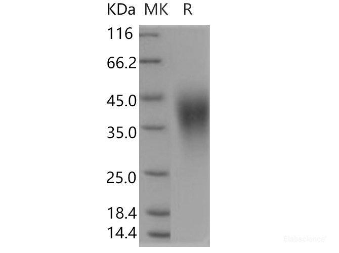 Recombinant Human B7-H5 / Gi24 / VISTA Protein (His tag)-Elabscience