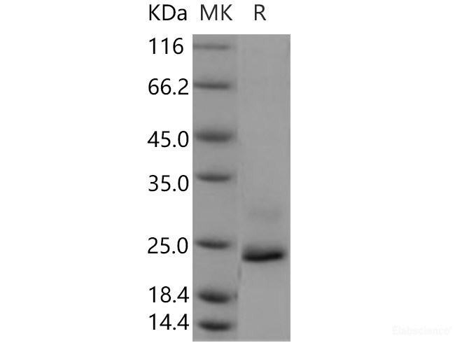 Recombinant Human Lysozyme G-like 1 / LYG1 Protein (His tag)-Elabscience