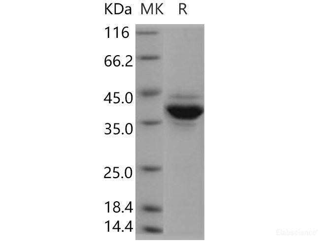 Recombinant Human Jumping Translocation Breakpoint / JTB Protein (Fc tag)-Elabscience