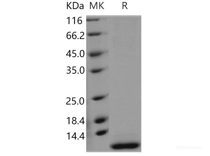 Recombinant Human SMR3B Protein (His tag)-Elabscience