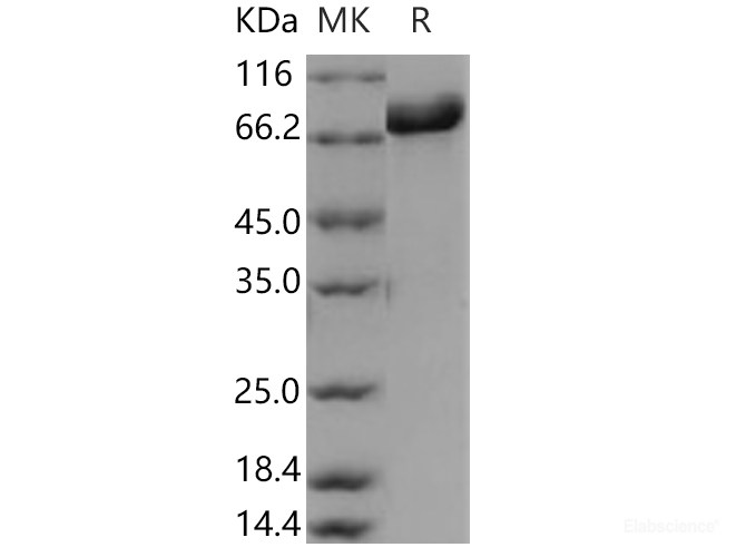 Recombinant Human DBH / Dopamine beta-Hydroxylase Protein (His tag)-Elabscience